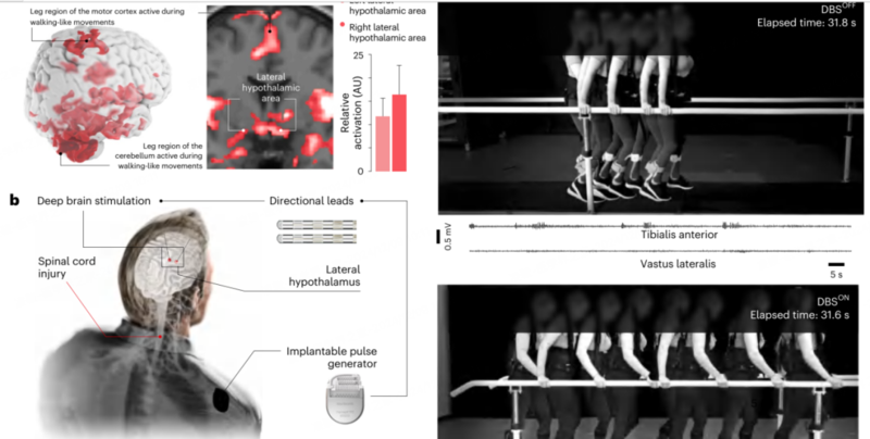 治疗机理 治疗机理